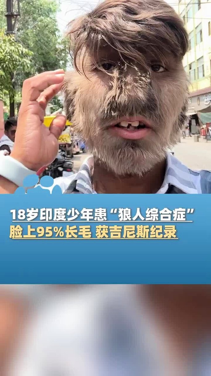 18岁禁止在线观看的相关介绍